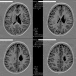 [0]-Fig.-6-Brain-Overview-2011