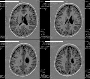 [0]-Fig.-6-Brain-Overview-2011